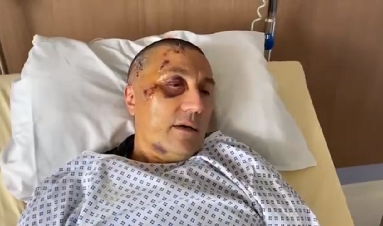 VIDEO CHOC : Le policier tombé dans le comas après une intervention s’exprime !