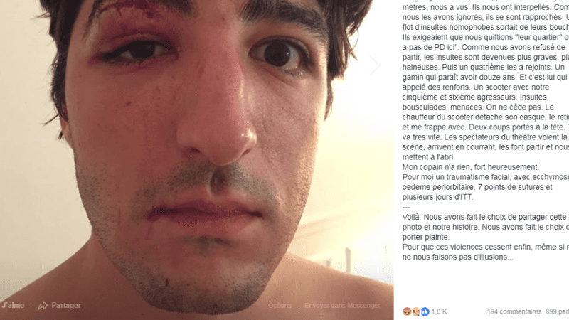 Agression homophobe à Paris: l’auteur condamné à 4 mois avec sursis, la victime dénonce une “justice à minima”