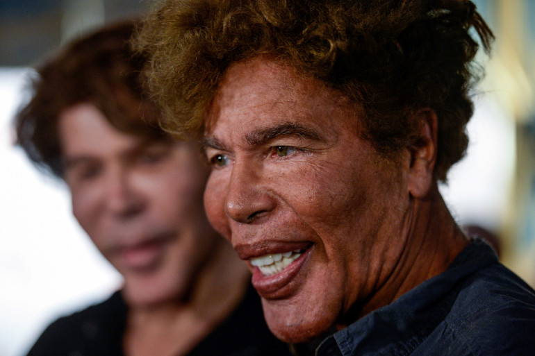 Igor Bogdanoff hospitalisé !