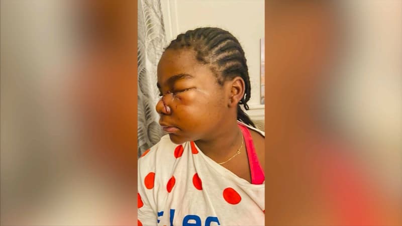 Chambéry: plainte classée sans suite pour la collégienne qui dénonçait un acte raciste après sa chute