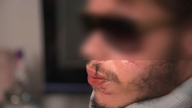 “Il faut qu’il y ait justice”: un homme accuse un policier de l’avoir agressé “sans aucune raison” à Paris