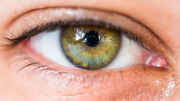  Elle pense avoir une cataracte, les médecins font une découverte ahurissante en l’opérant