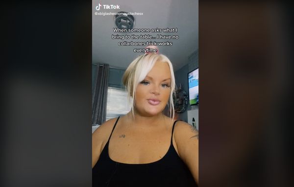 TÉMOIGNAGE  Je suis née sans clavicules et mes deux épaules peuvent se toucher