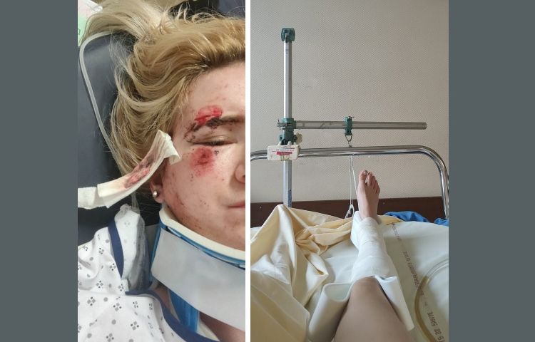 Nantes : Renversée par une voiture en fuite, elle lance un appel sur les réseaux