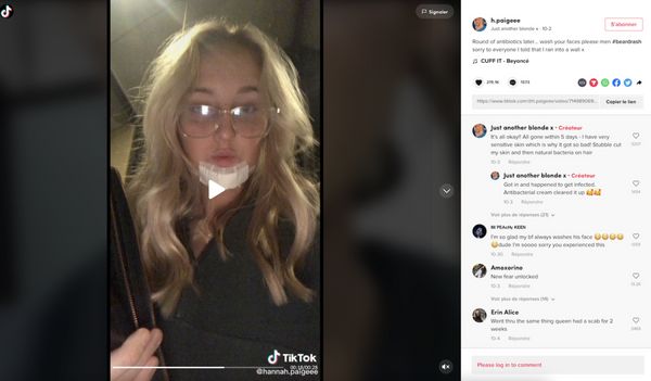 Elle attrape une infection à cause de la barbe de son copain