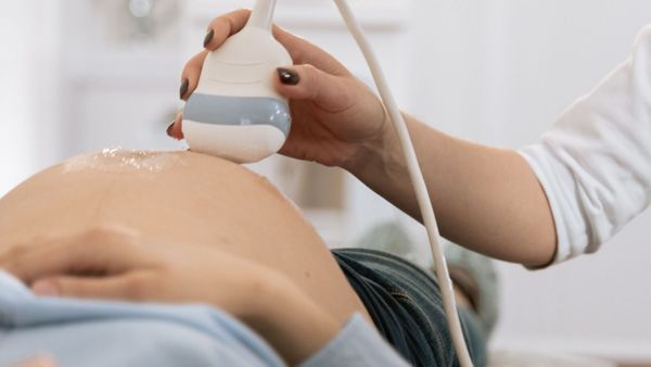 Incroyable ! Elle sauve la vie de sa soeur jumelle avant leur naissance