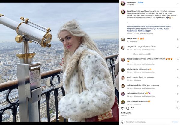 TÉMOIGNAGE  Les gens se moquent de mon monosourcil mais je refuse de l’épiler