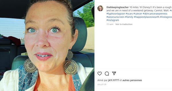 TÉMOIGNAGE  J’ai réalisé que j’avais un cancer grâce à une photo publiée sur Facebook