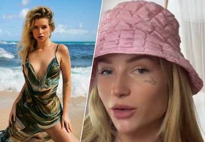 “Les enfants, ne buvez jamais d’alcool”: la sœur de Kate Moss se réveille avec un tatouage sur le visage