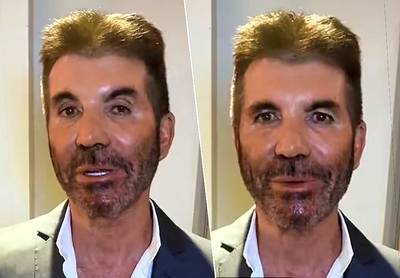 “Qu’est-il arrivé à son visage?”: méconnaissable, Simon Cowell inquiète ses fans