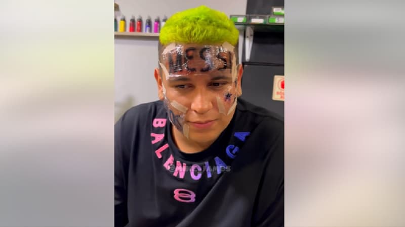 Coupe du monde: un supporter se fait tatouer le nom de Messi sur le front… et regrette son geste