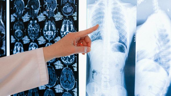 Diagnostiqué par erreur d’une maladie grave, il subit une conséquence dramatique