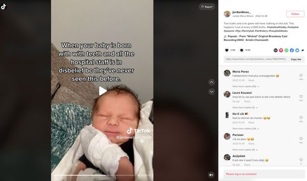 Phénomène rare ce bébé est né avec des dents