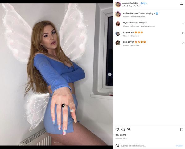 TÉMOIGNAGE  Née avec deux vagins j’ai mes règles deux fois par mois