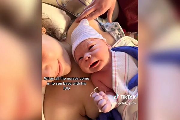 Elle tombe enceinte sous contraceptif, son bébé naît avec son stérilet dans la main