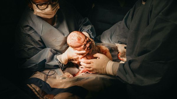 Le jumeau d’une fillette d’un an découvert dans son cerveau