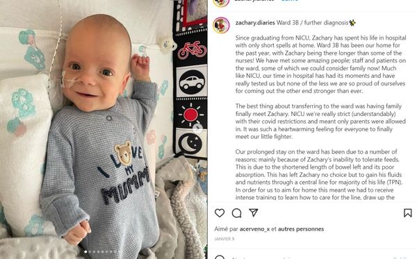 TÉMOIGNAGE Notre fils est né avec ses organes à l’extérieur de son corps