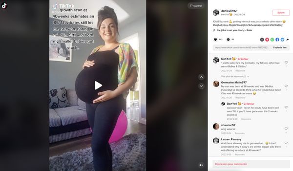 Elle accouche d’un très gros bébé et reçoit 200 points de suture