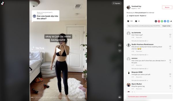 TÉMOIGNAGE Je vis avec un unisein, une malformation rare
