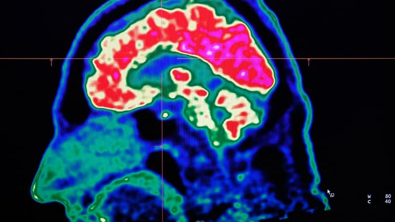 Des scientifiques britanniques à la recherche de personnes avec une “super mémoire”