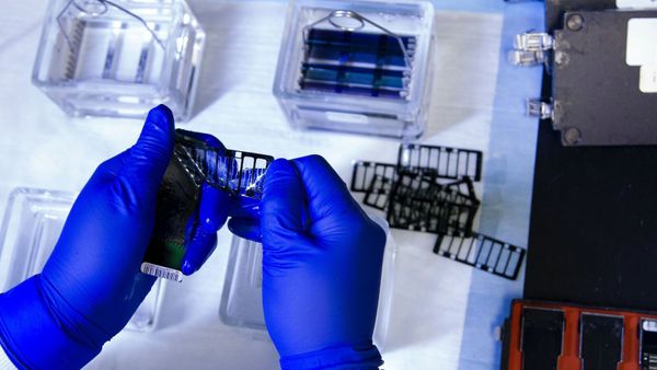 Une personne sur vingt : cette maladie sournoise qu’il est très difficile de diagnostiquer