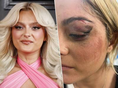Bebe Rexha blessée par un téléphone lancé sur scène en plein concert, son agresseur “trouvait ça drôle”