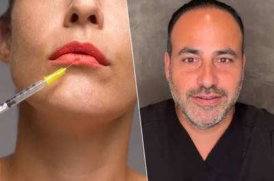 L’étonnante révélation d’un chirurgien plastique: “Les acteurs en grève enchaînent les opérations esthétiques”