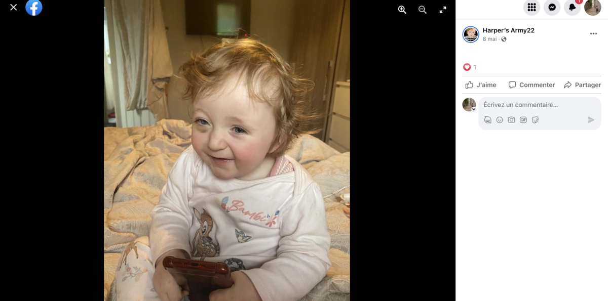 TÉMOIGNAGE. « Mon bébé s’est retrouvé sans raison avec un oeil au beurre noir, le diagnostic est terrible »