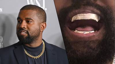 Kanye West s’offre de nouvelles dents en titane: “Ça coûte environ 780.000 euros”