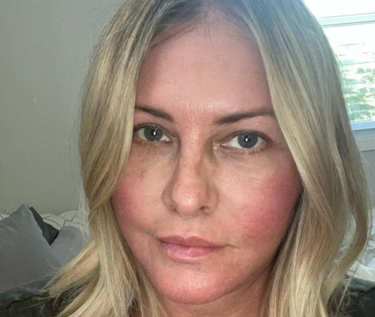Nicole Eggert atteinte d’un cancer du sein : la star d’Alerte à Malibu dévoile sa maladie et raconte ses symptômes