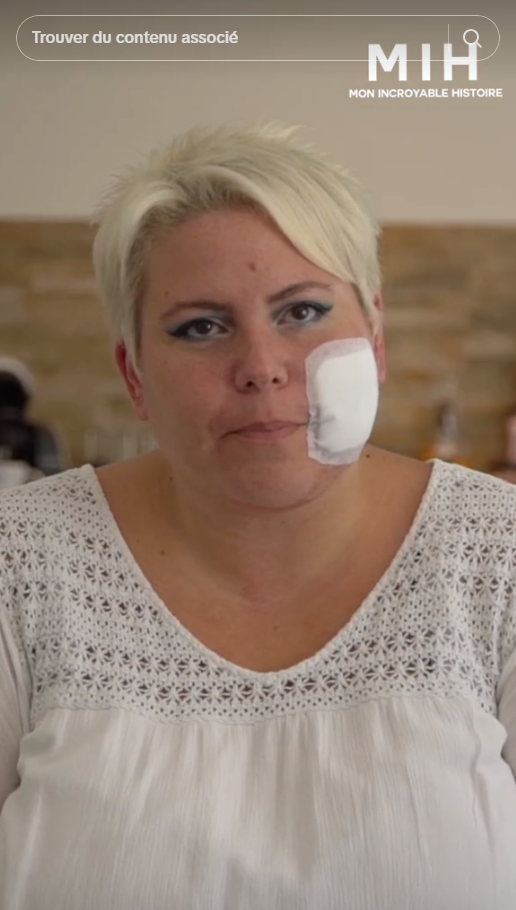 En nettoyant son four, elle se déclenche une maladie rarissime qui la brûle de l’intérieur