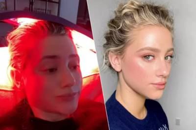 L’actrice Lili Reinhart révèle souffrir d’alopécie après avoir traversé un grave épisode dépressif