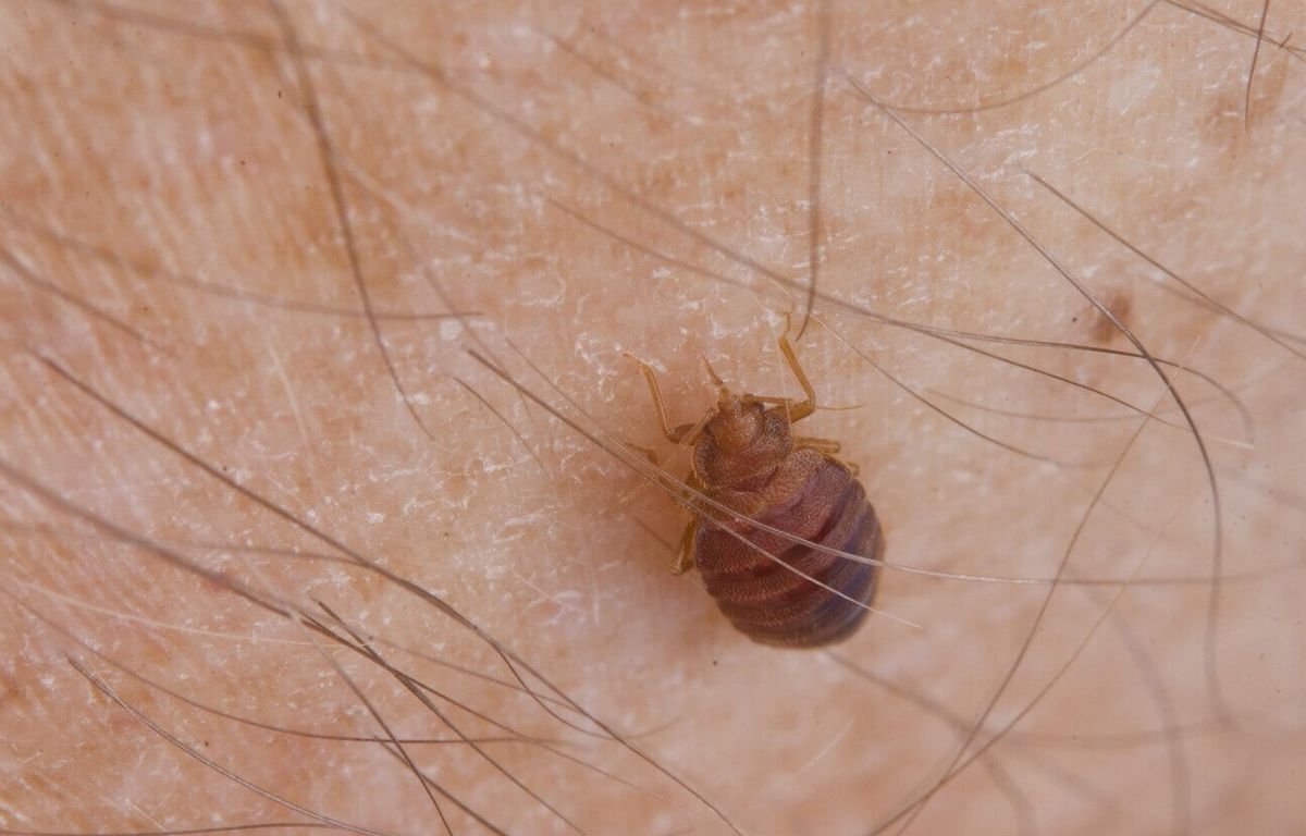 Pas-de-Calais : Un patient arrive infesté de punaises de lit, les urgences d’Arras à l’arrêt