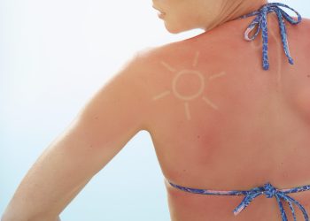 Qu’est-ce que la tendance dangereuse des «sun-tattoos» ?