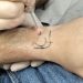 Quand l’encre devient un fardeau : la nouvelle tendance du détatouage