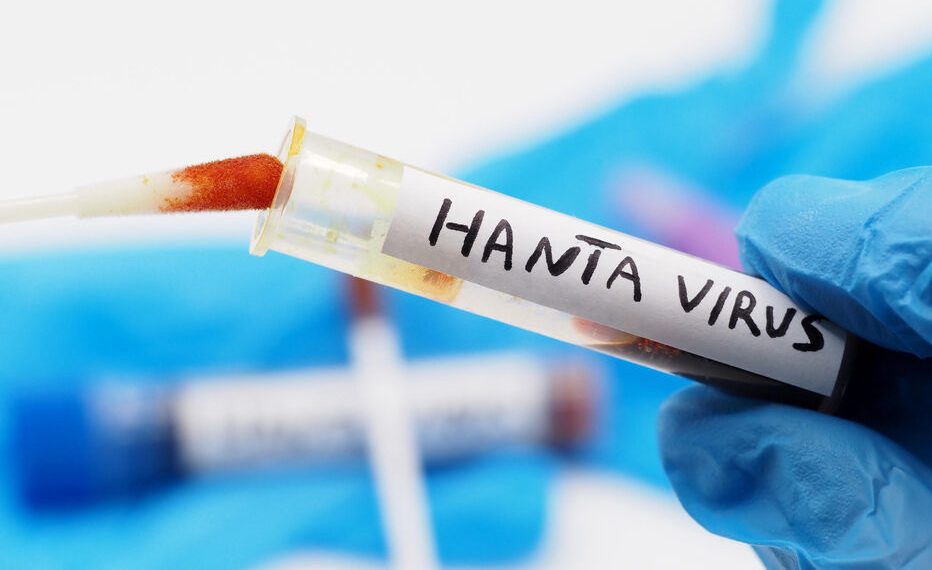 Hantavirus – La Française contaminée maintenue en vie via un poumon artificiel !